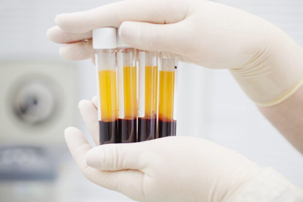 Arzneimittel aus Blut: Lebensrettende Biopharmazeutika
