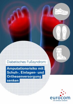 Amputationsrisiko mit Schuhen, Einlagen und Orthesen senken:eurocom veröffentlicht neues Handbuch zur risikoklassegerechten orthopädie(schuh)technischen Versorgung bei Diabetischem Fußsyndrom