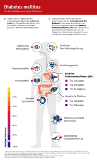 Hypoglykämierisiko bei Diabetes mellitus: exokrine Pankreasinsuffizienz   